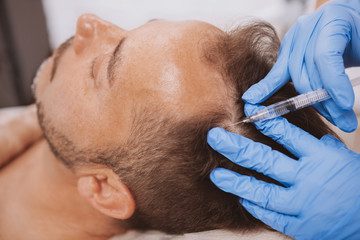 How To Prevent A Hair Transplant Infection