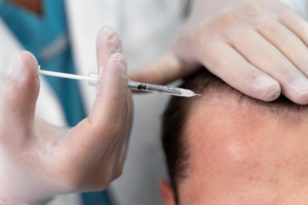 The Best Age For Hair Transplant