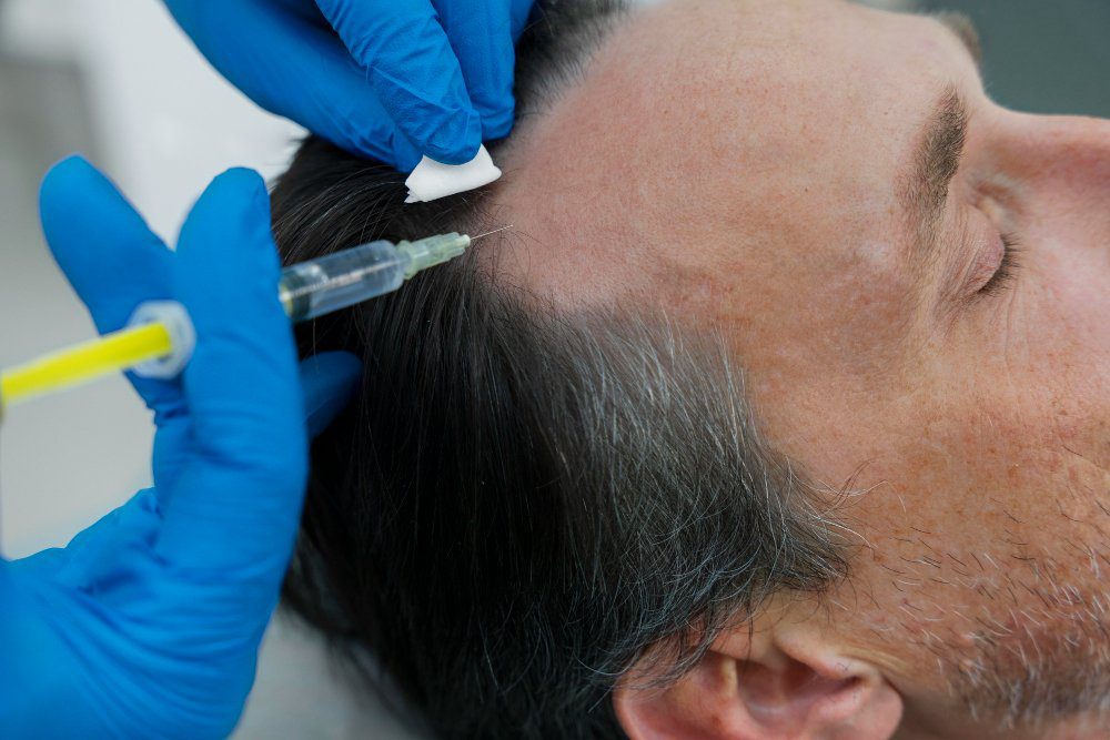 The Current State Of Hair Restoration
