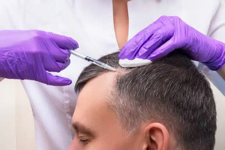 Hair Transplant for Different Ethnicities: Tailored Solutions