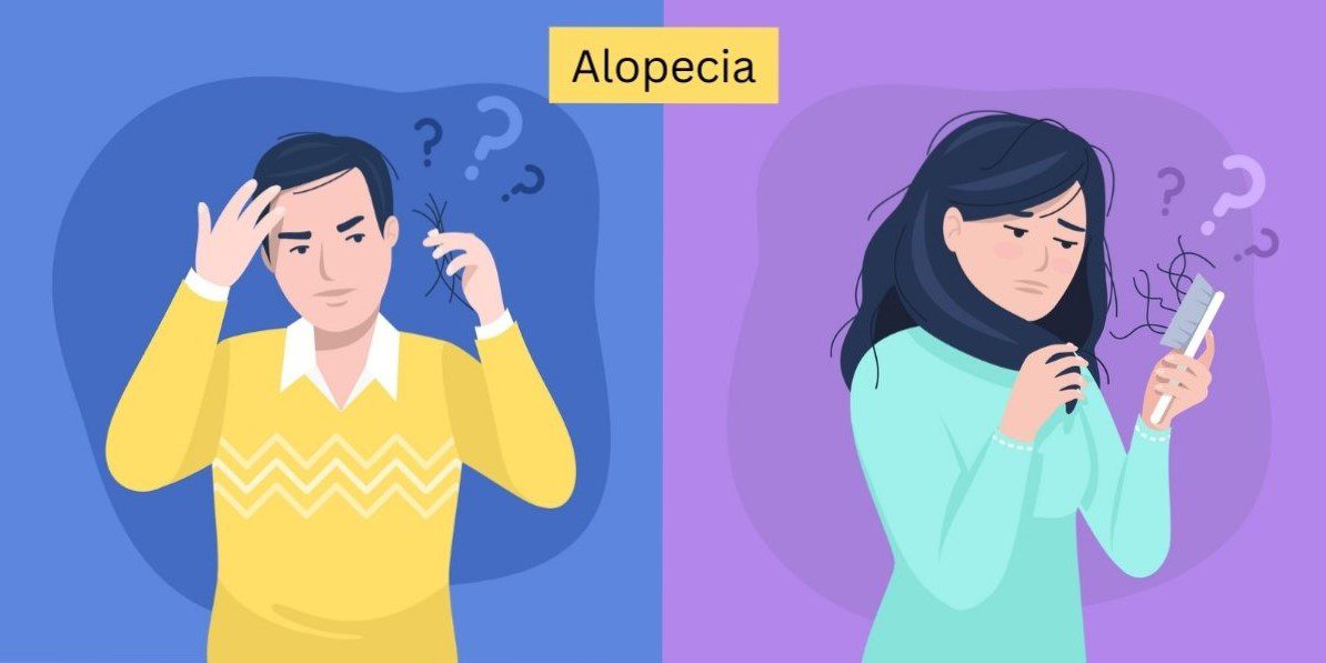 What Are The Types Of Hair Loss Or Alopecia?