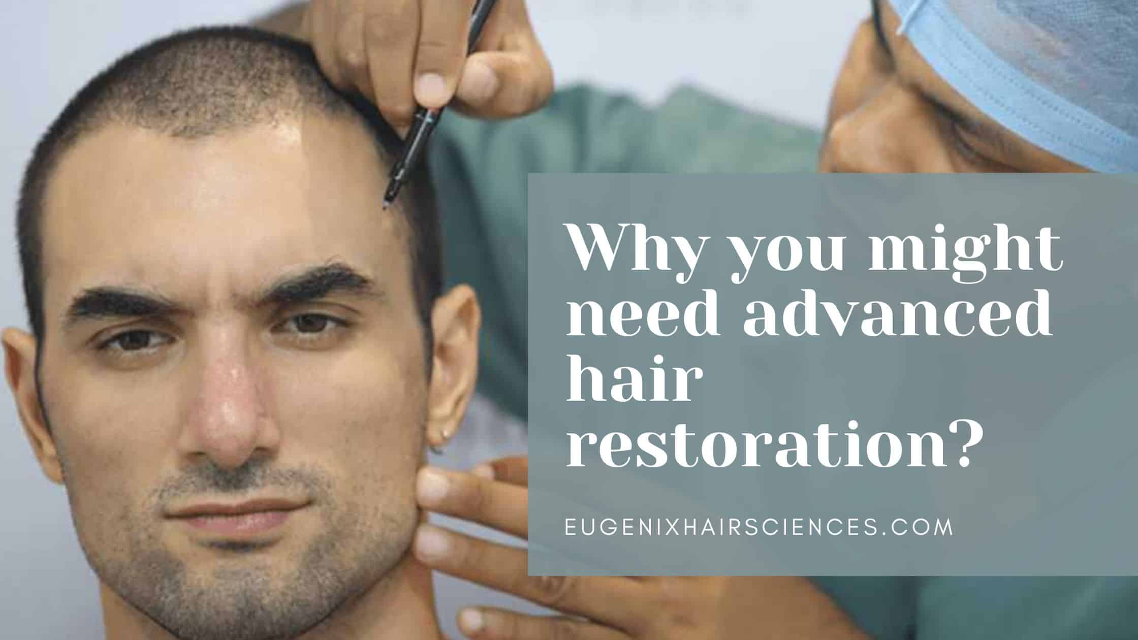 Why You Might Need Advanced Hair Restoration?