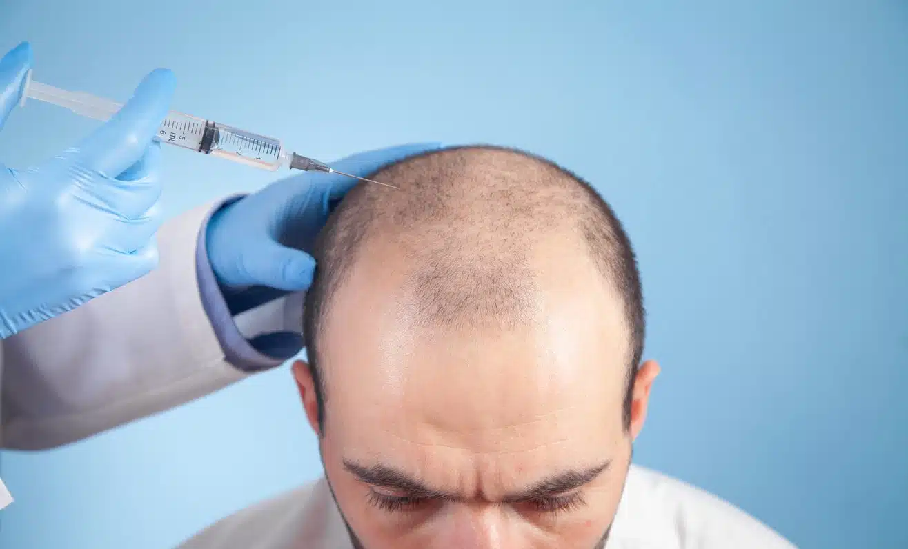 Choosing the Right Hair Transplantation Clinic in India: A Comprehensive Guide