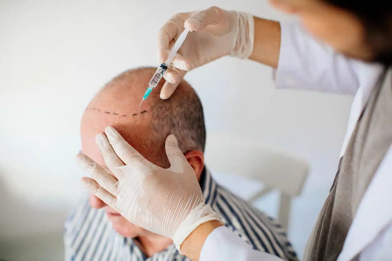 Patient Education: Empowering Safety and Well-Being in Hair Transplants