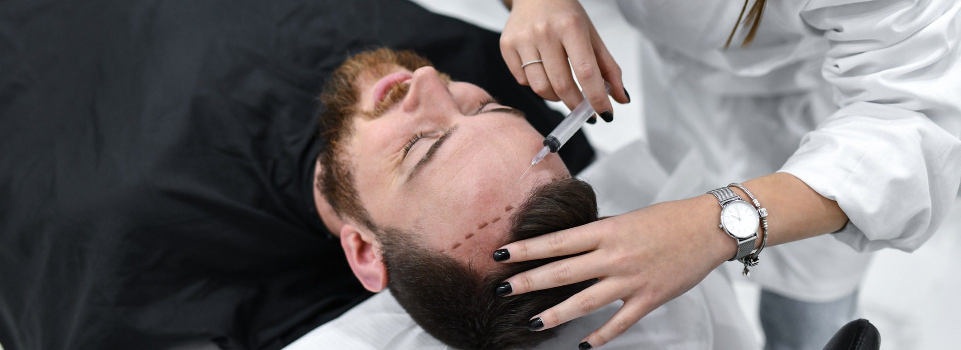 Hair Transplant Before and After: Managing Expectations