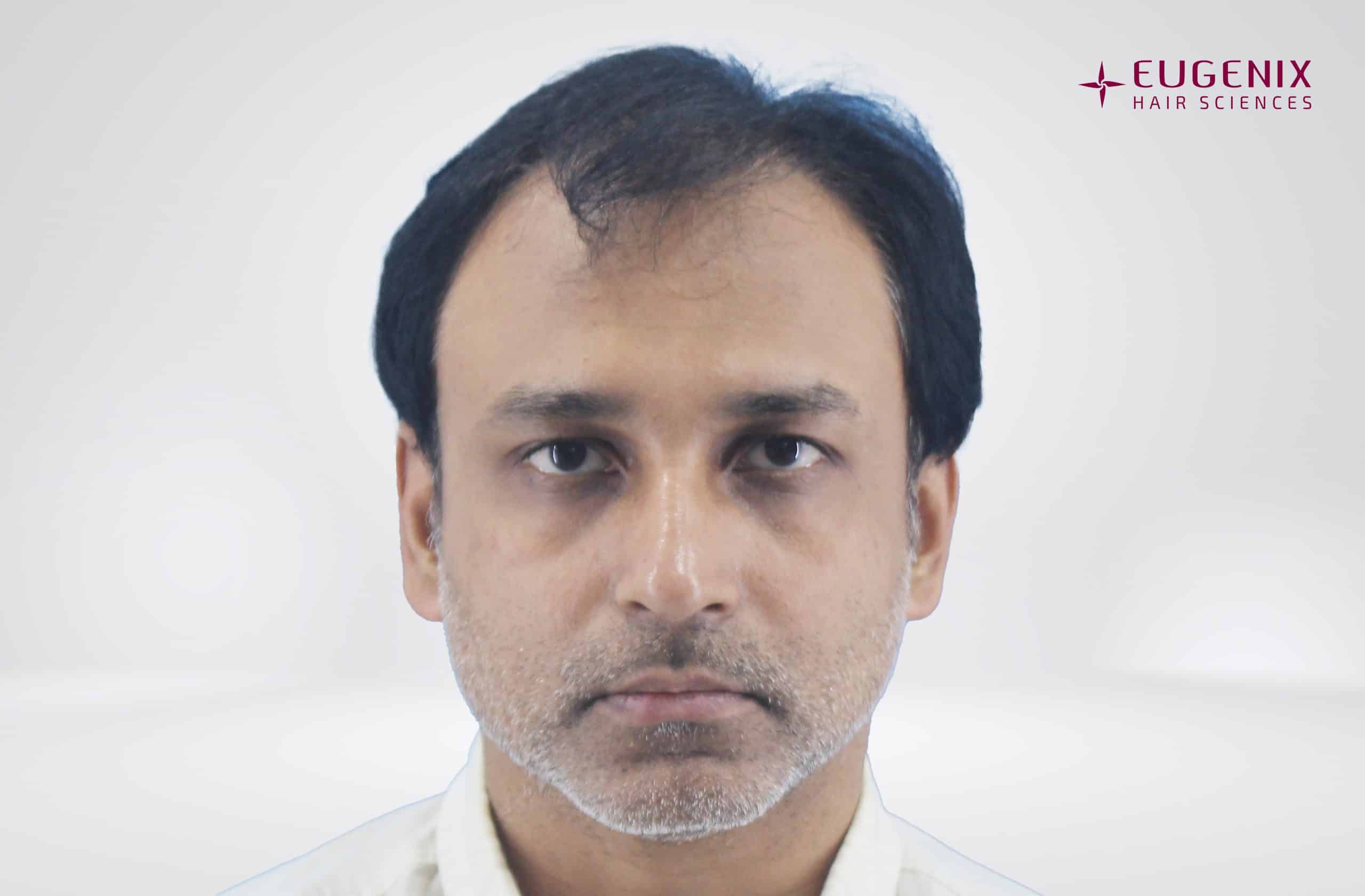 Rahul Front Before