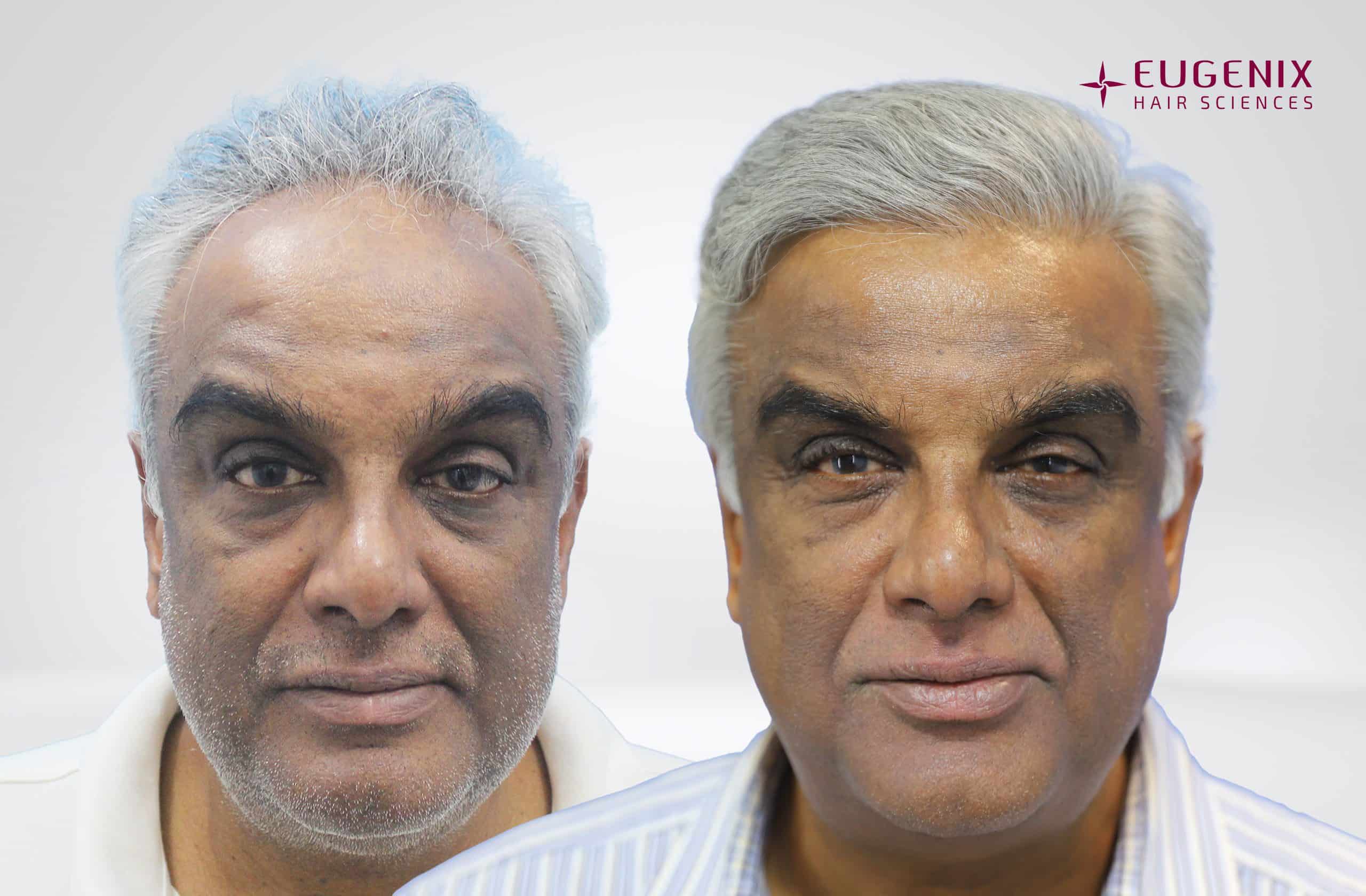 Satish Front Before After