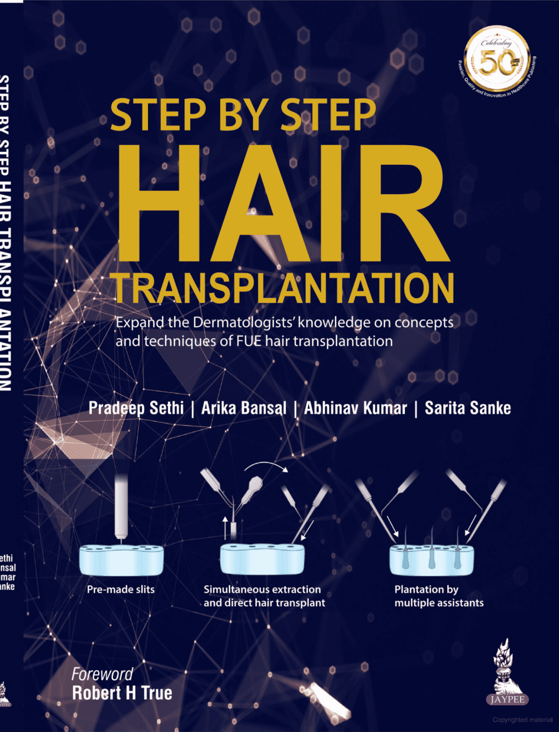 hair-transplant-book-dht