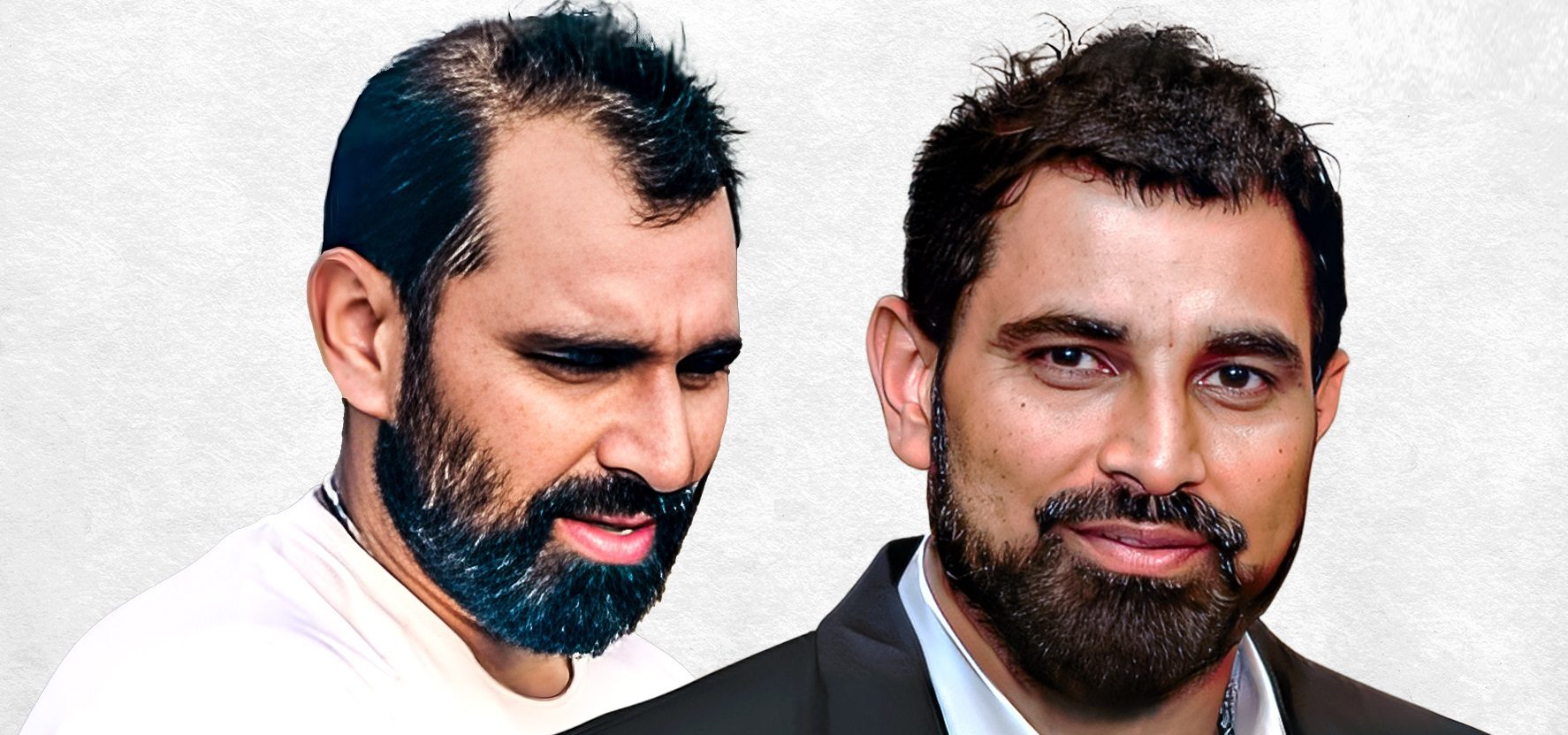 Cricketer Mohammed Shami’s Triumph Over Hair Loss with Eugenix Hair Sciences
