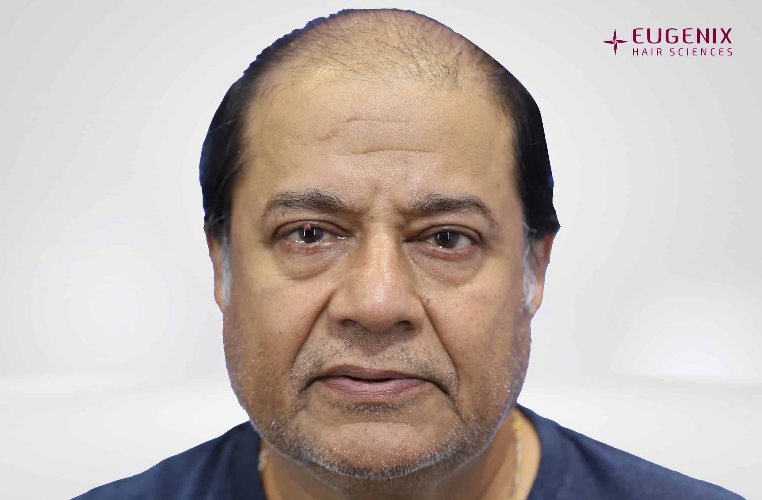 Anup Jalota Front Before