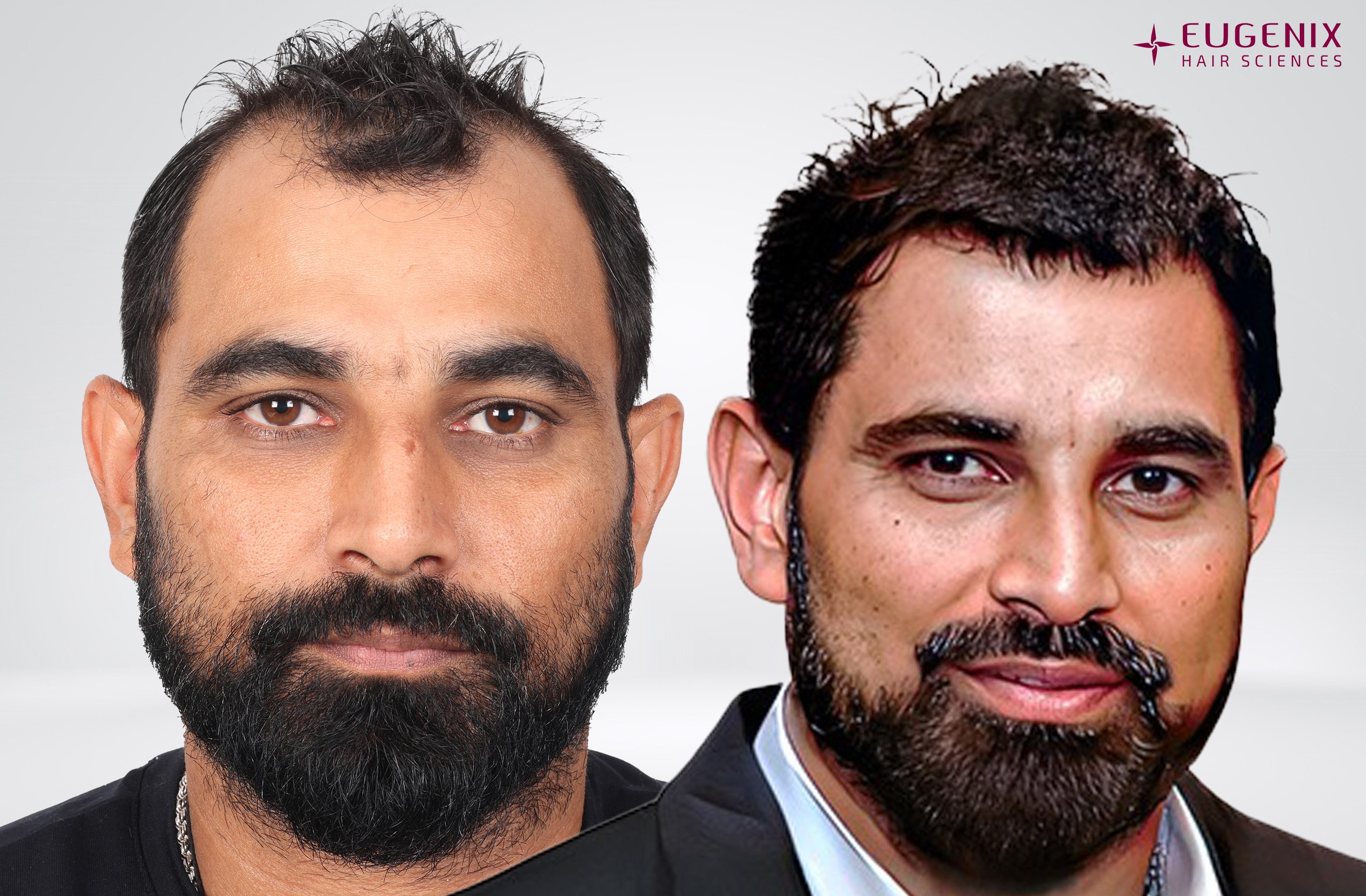 Mohd Shami Front Before and After