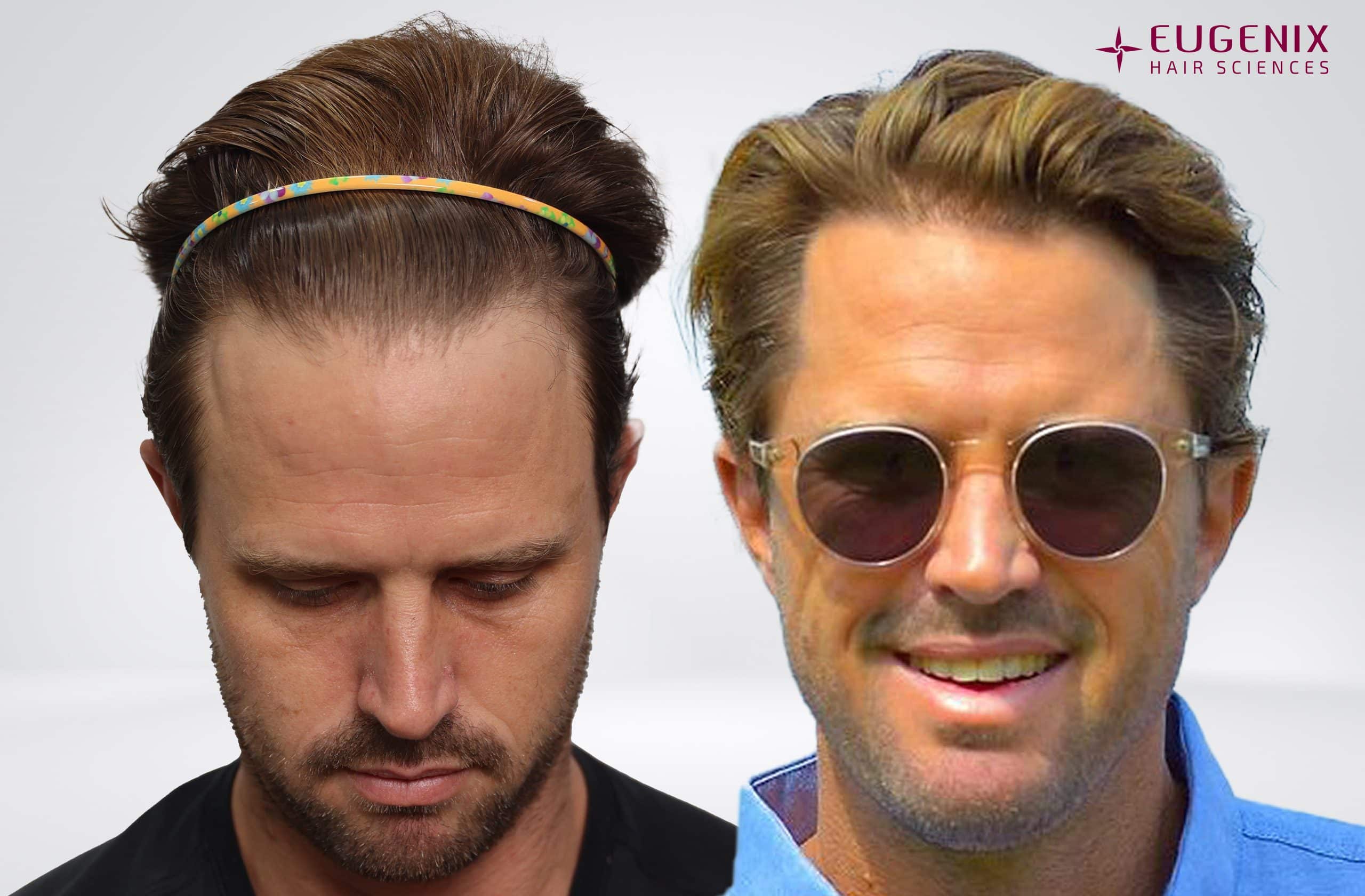 Nick Compton Front Before and After