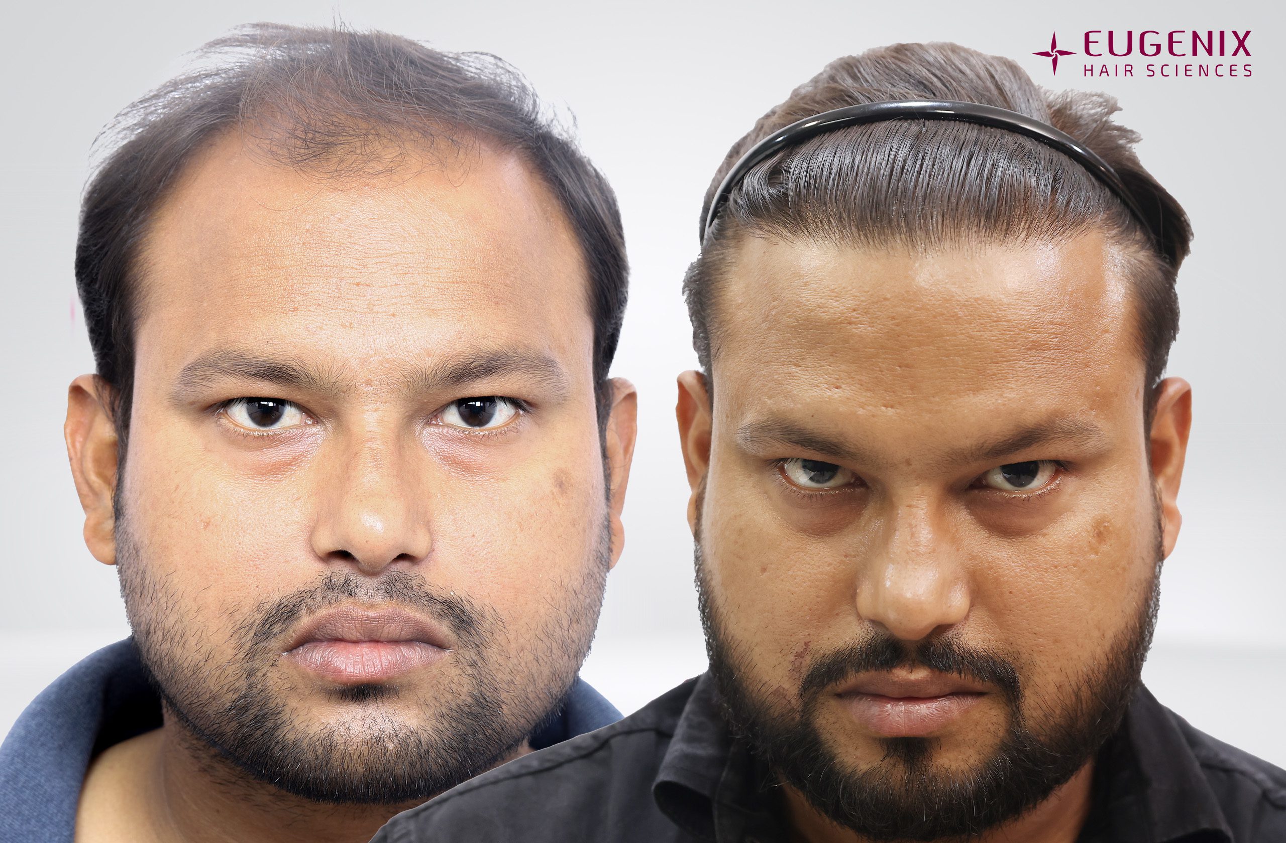 Sandeep Gupta Front Before and After