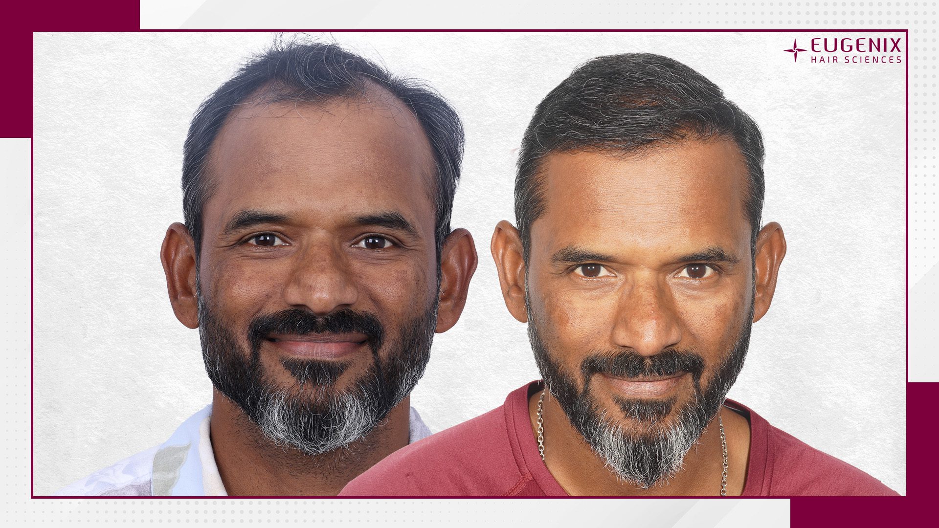 Sridhar AFter and Before