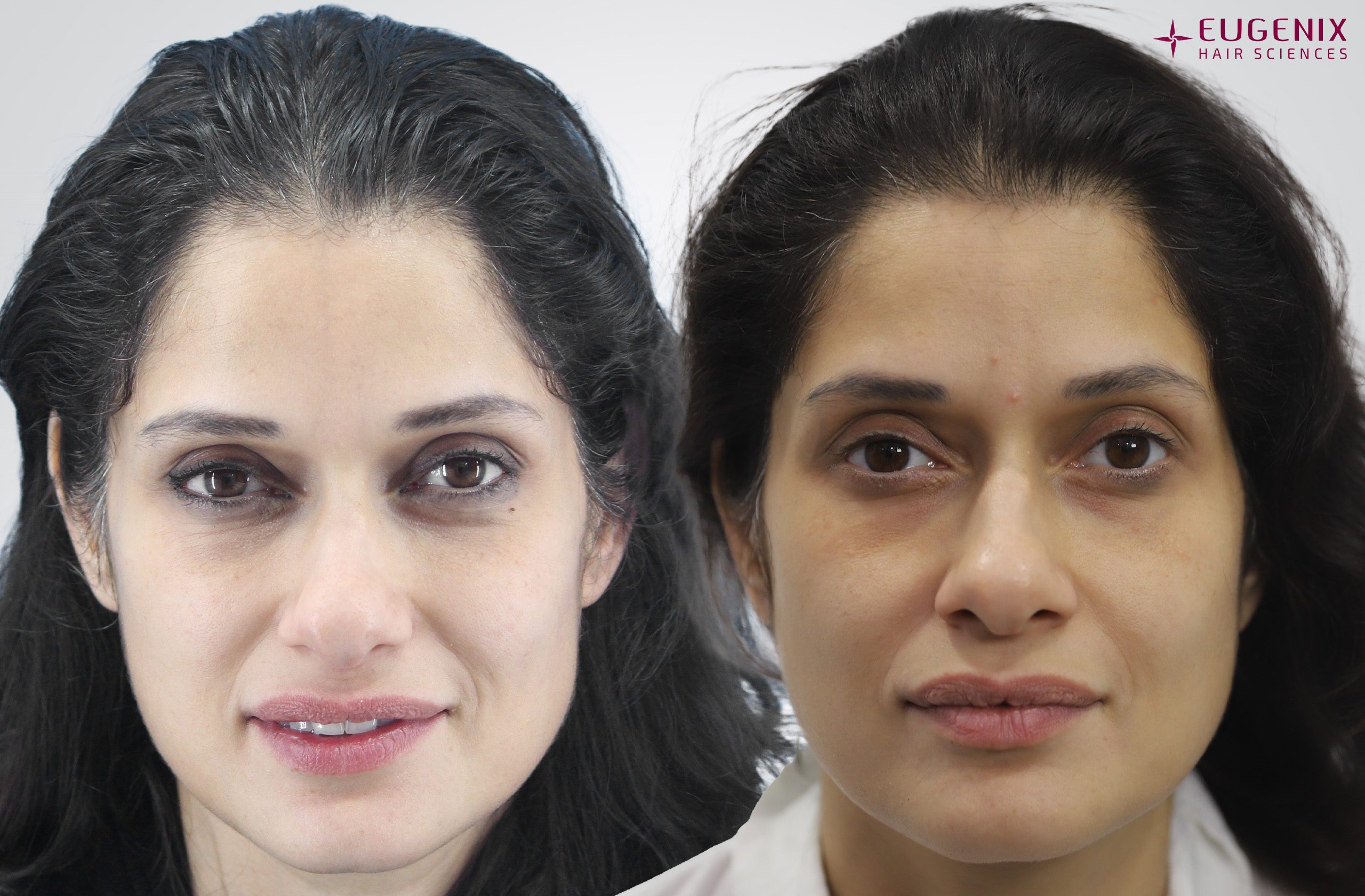 VIDUSHI MEHRA Front Before and After