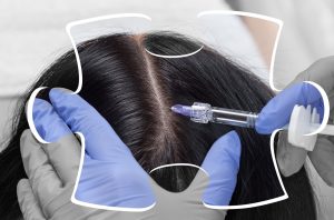hair-transplant-cost-in-india