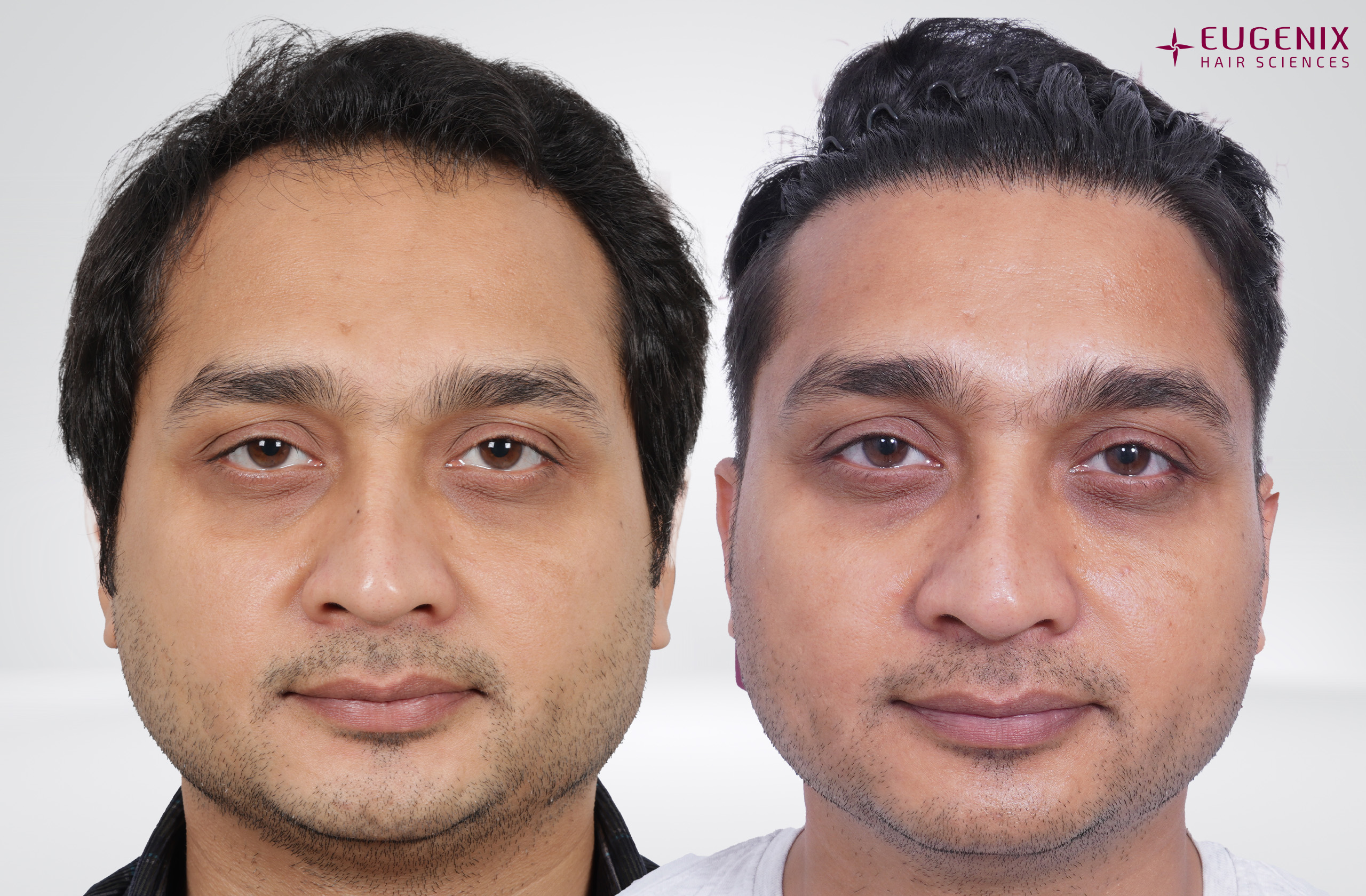 AJAY TYAGI Front Before and After