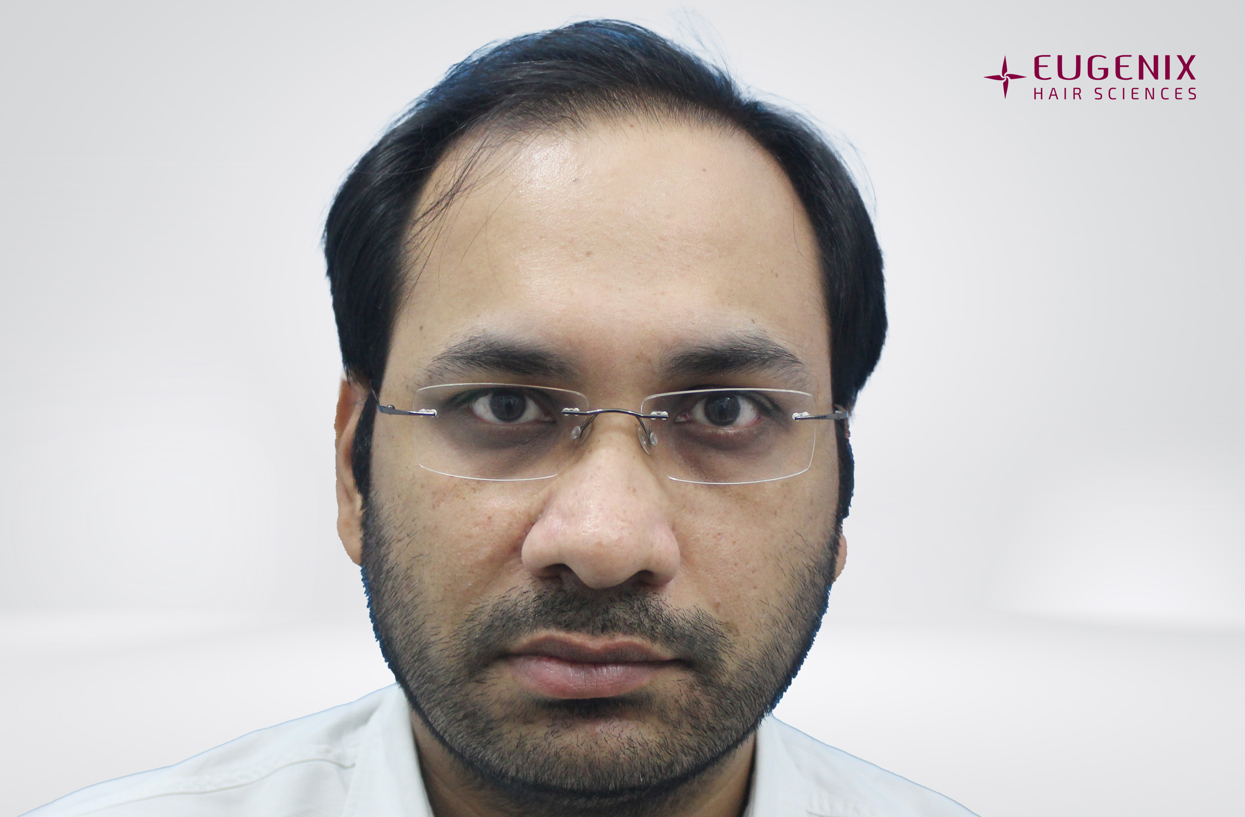 DR AMIT RANA Front Before