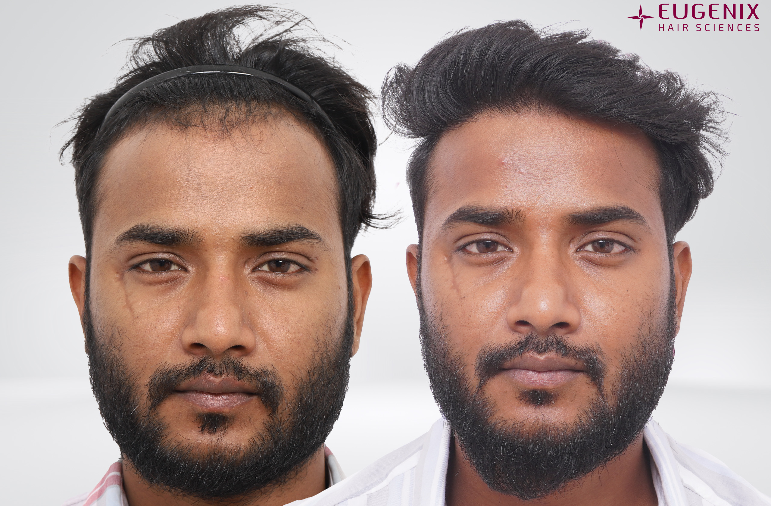 Irshad Front Before After