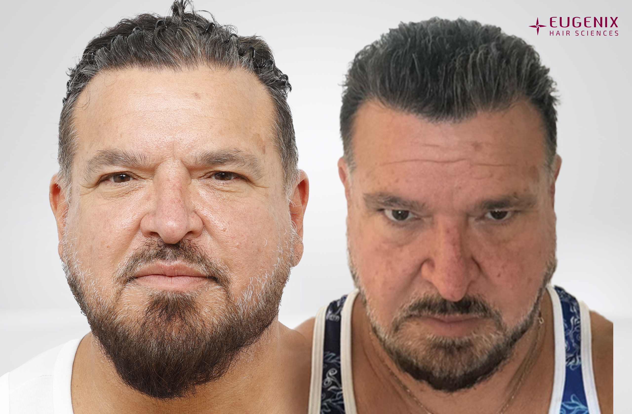 JASON PAUL PACHECO Front Before and After