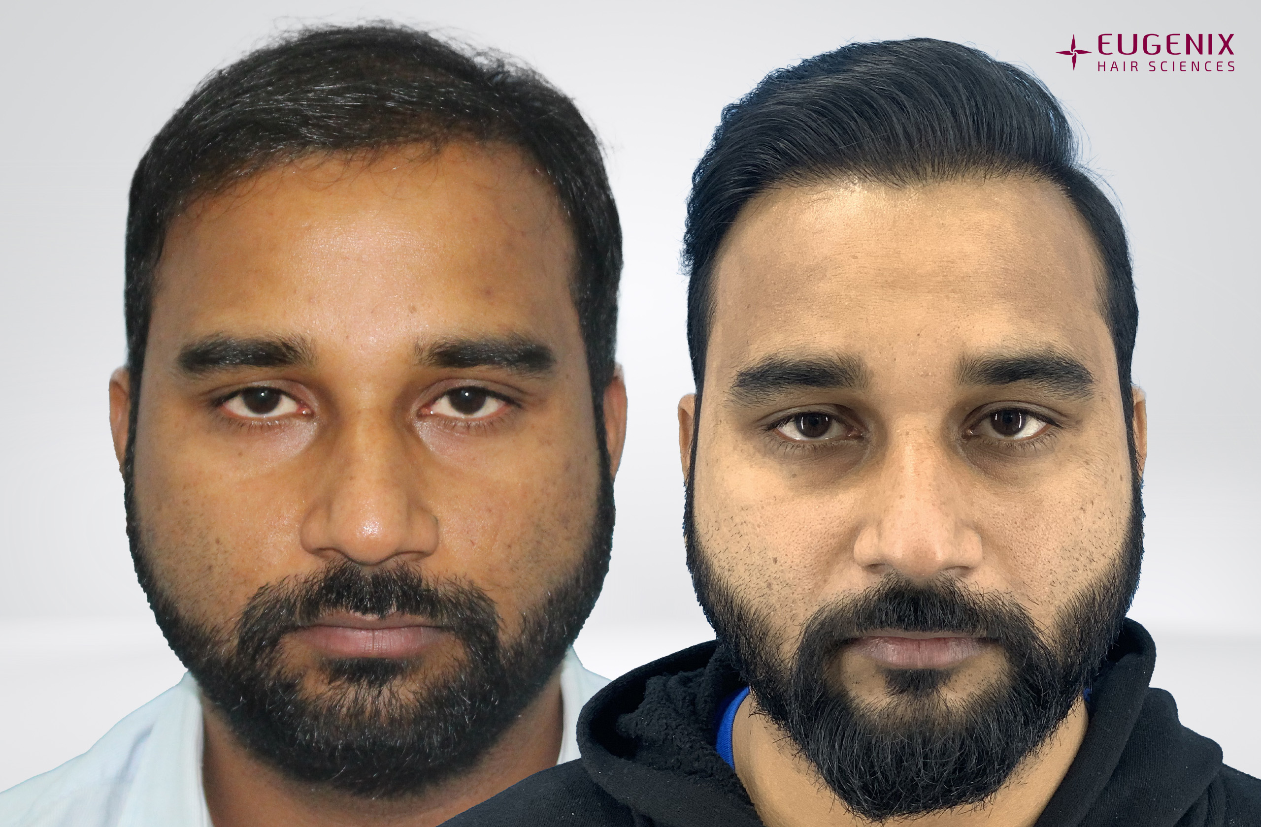 NISHAT KUMAR Front Before & After