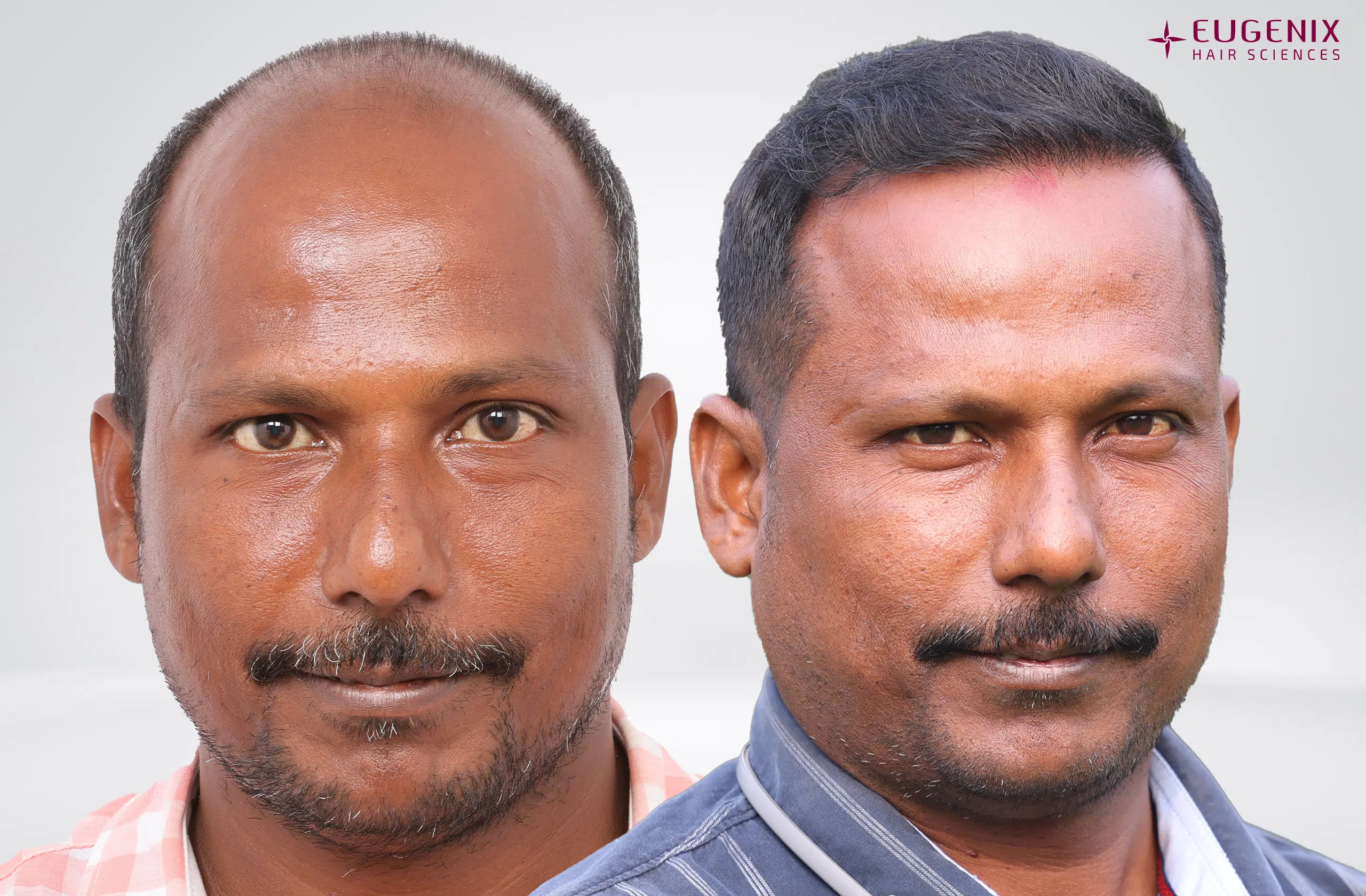 Niranjan Reddy Front Before & After
