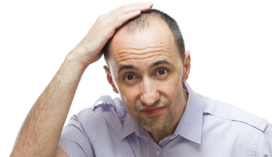 Hair Transplant vs Other Hair Loss Solutions: Making the Right Choice