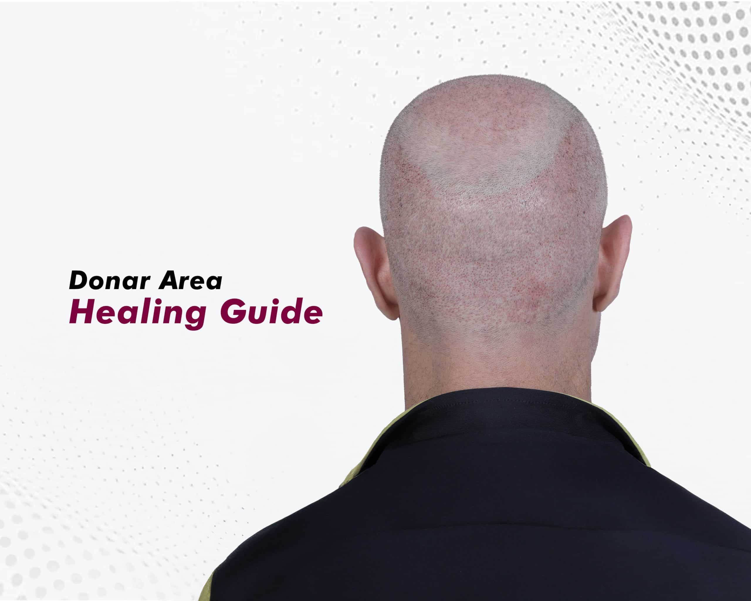 Donor Area Healing Guide