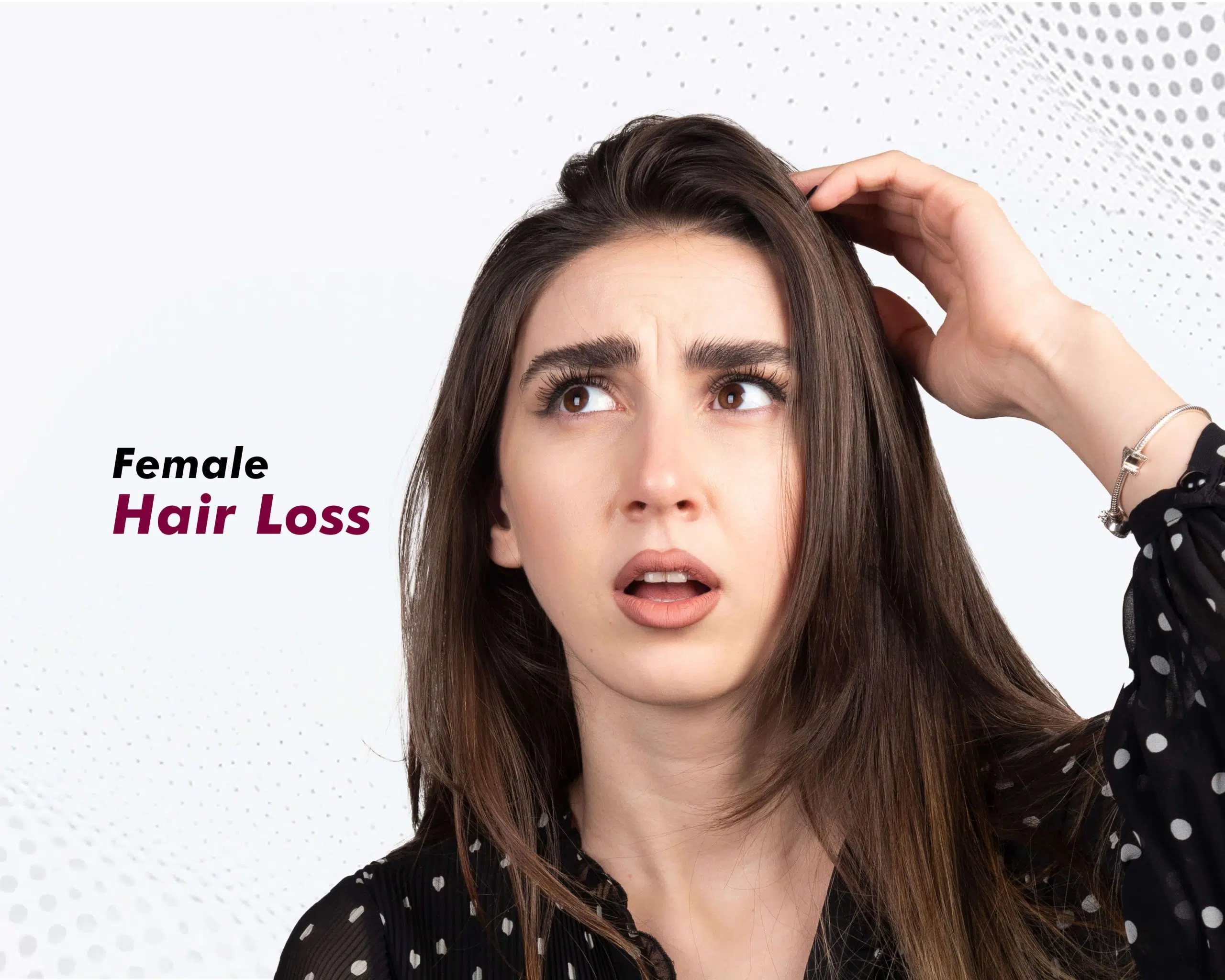 Female Hair Loss