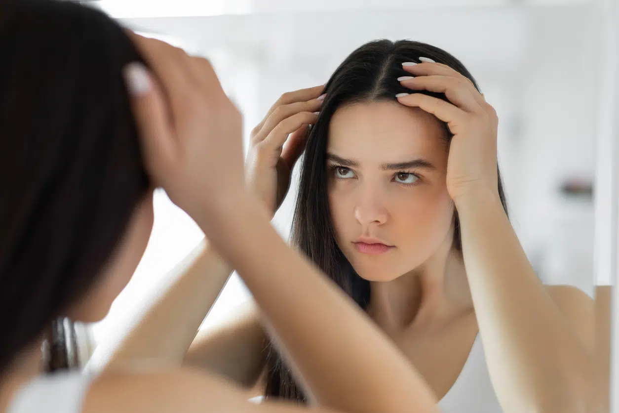 Woman having problem with hair loss