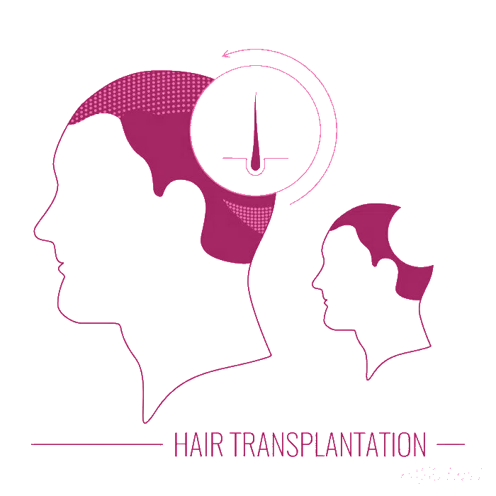 hair-transplant-correction-icon