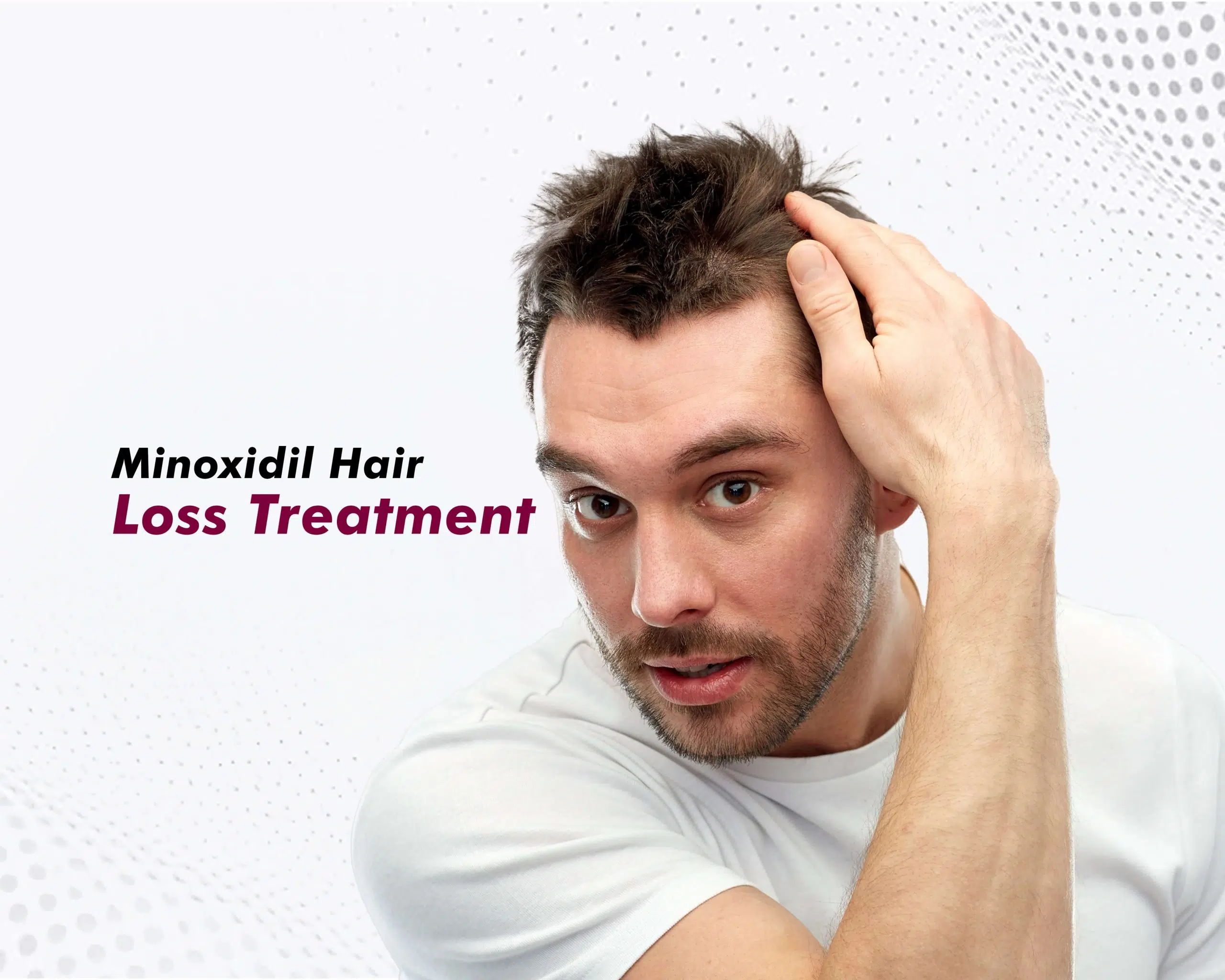 Minoxidil Hair Loss Treatment