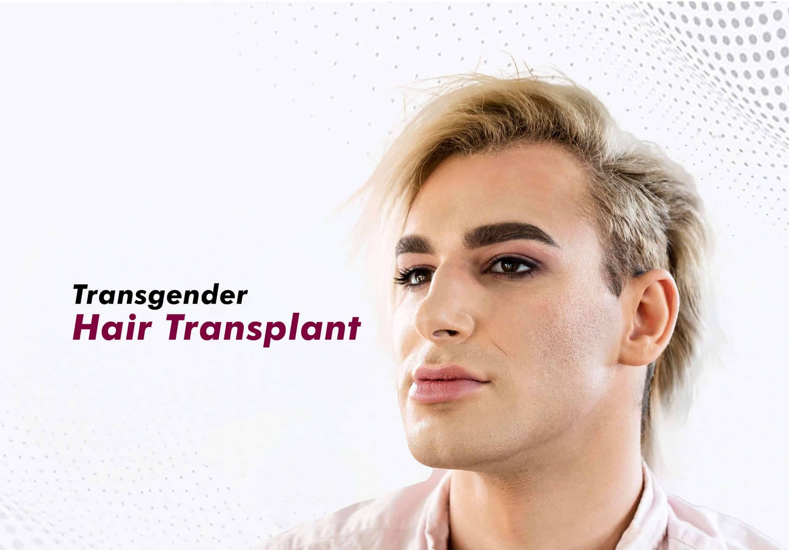 Transgender Hair Transplant