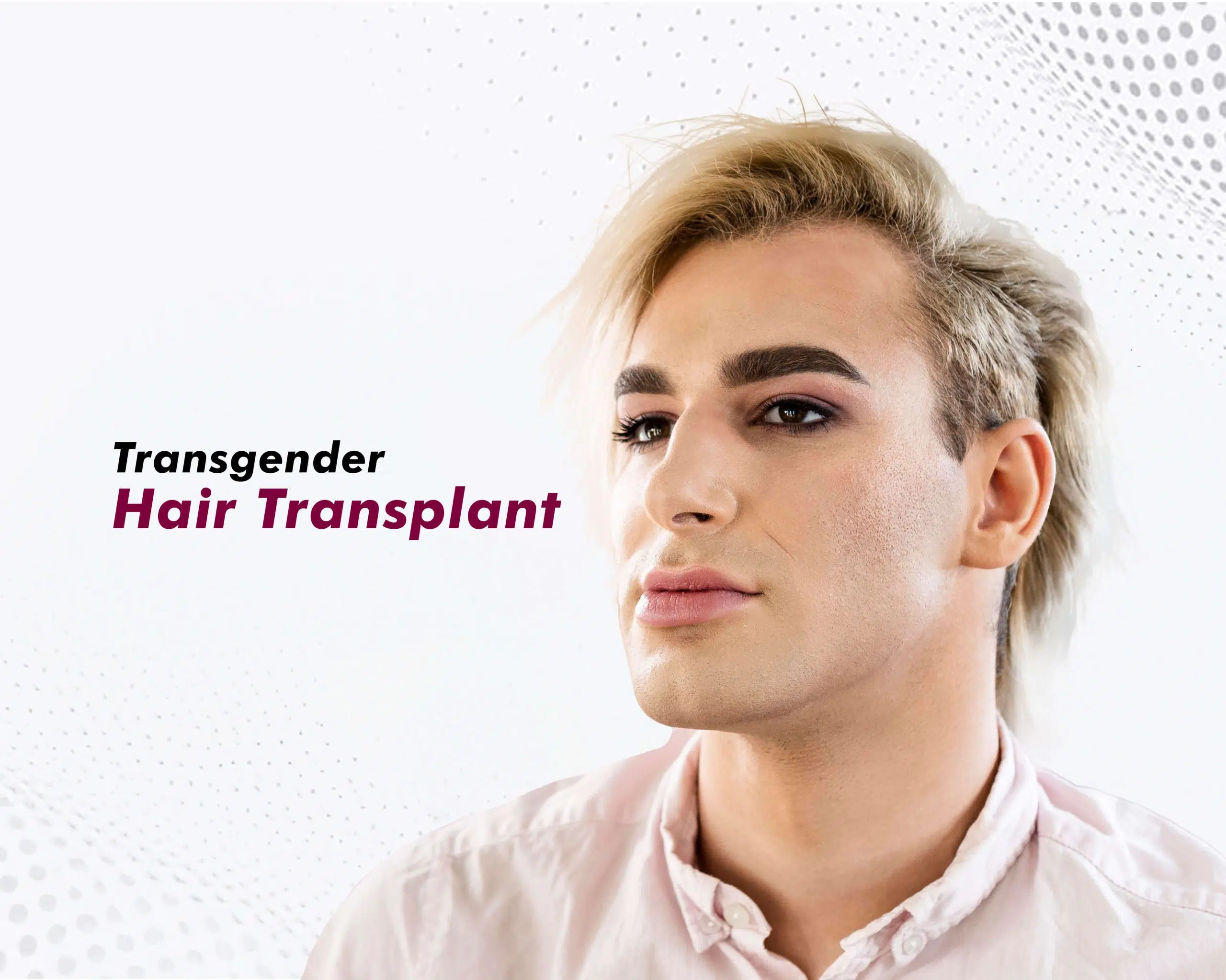 Transgender Hair Transplant