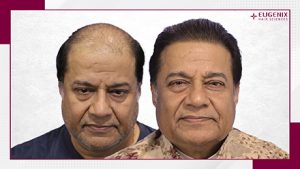 Anup Jalota