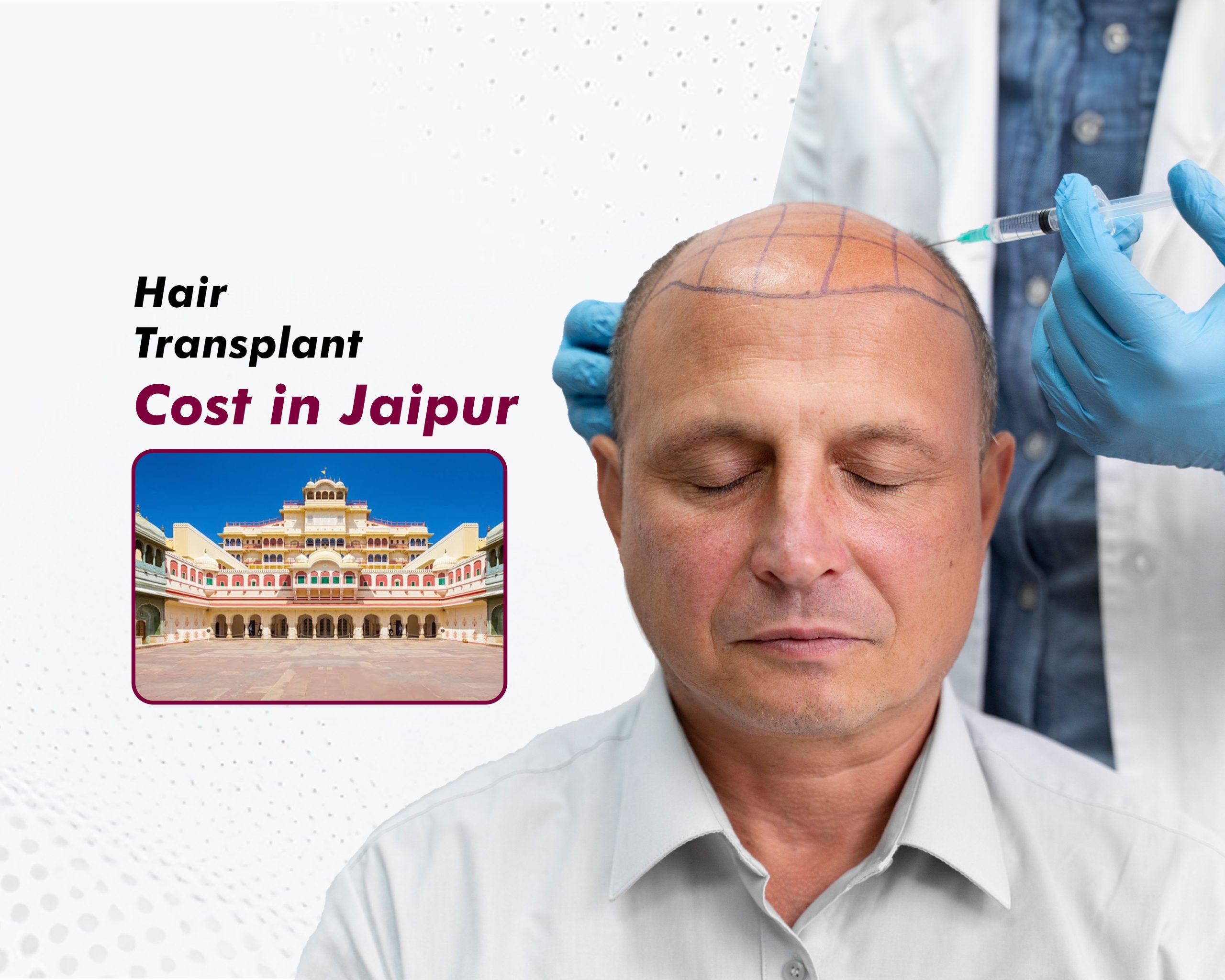 Hair Transplant Cost in Jaipur