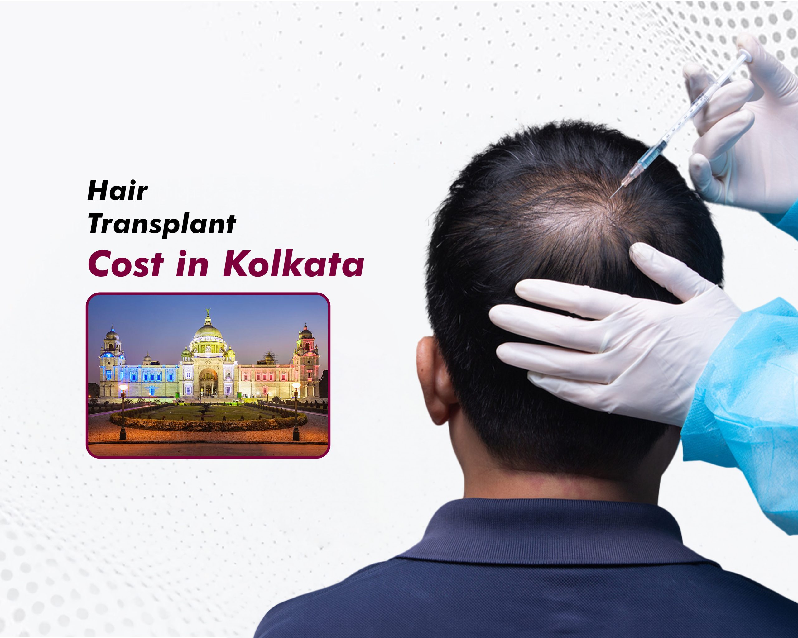 Hair Transplant Cost in Kolkata