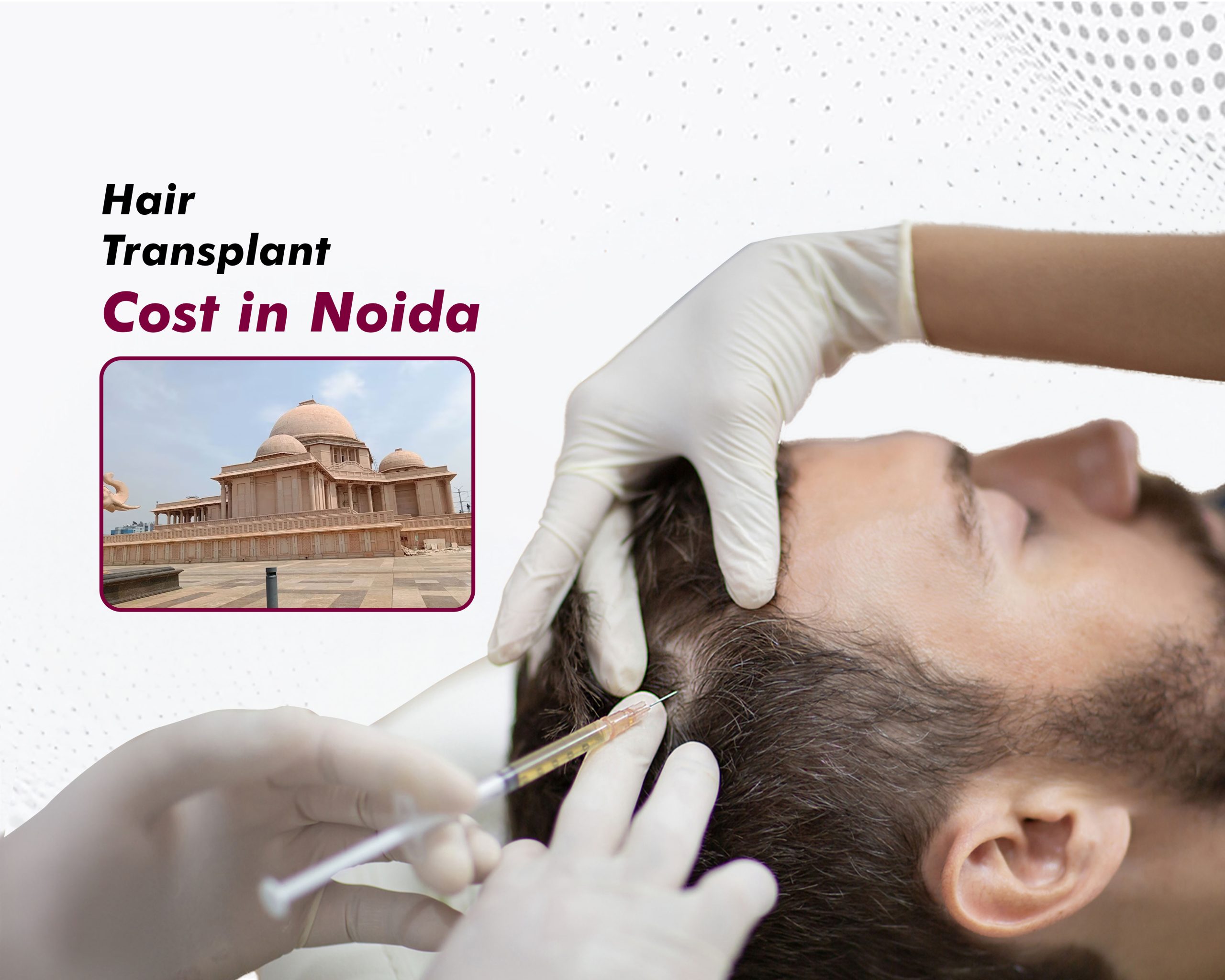 Hair Transplant Cost in Noida