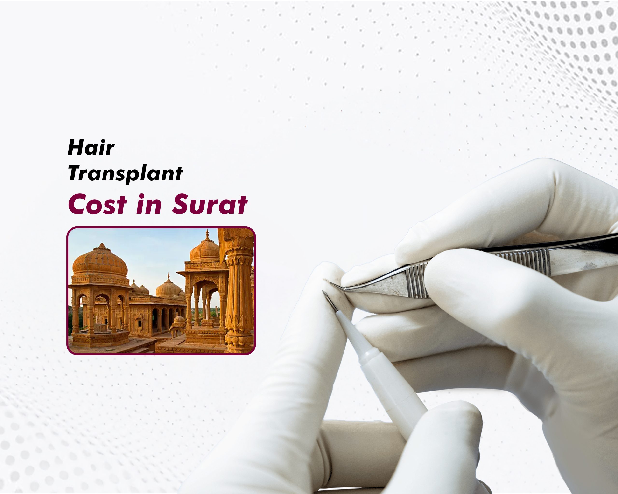 Hair Transplant Cost in Surat