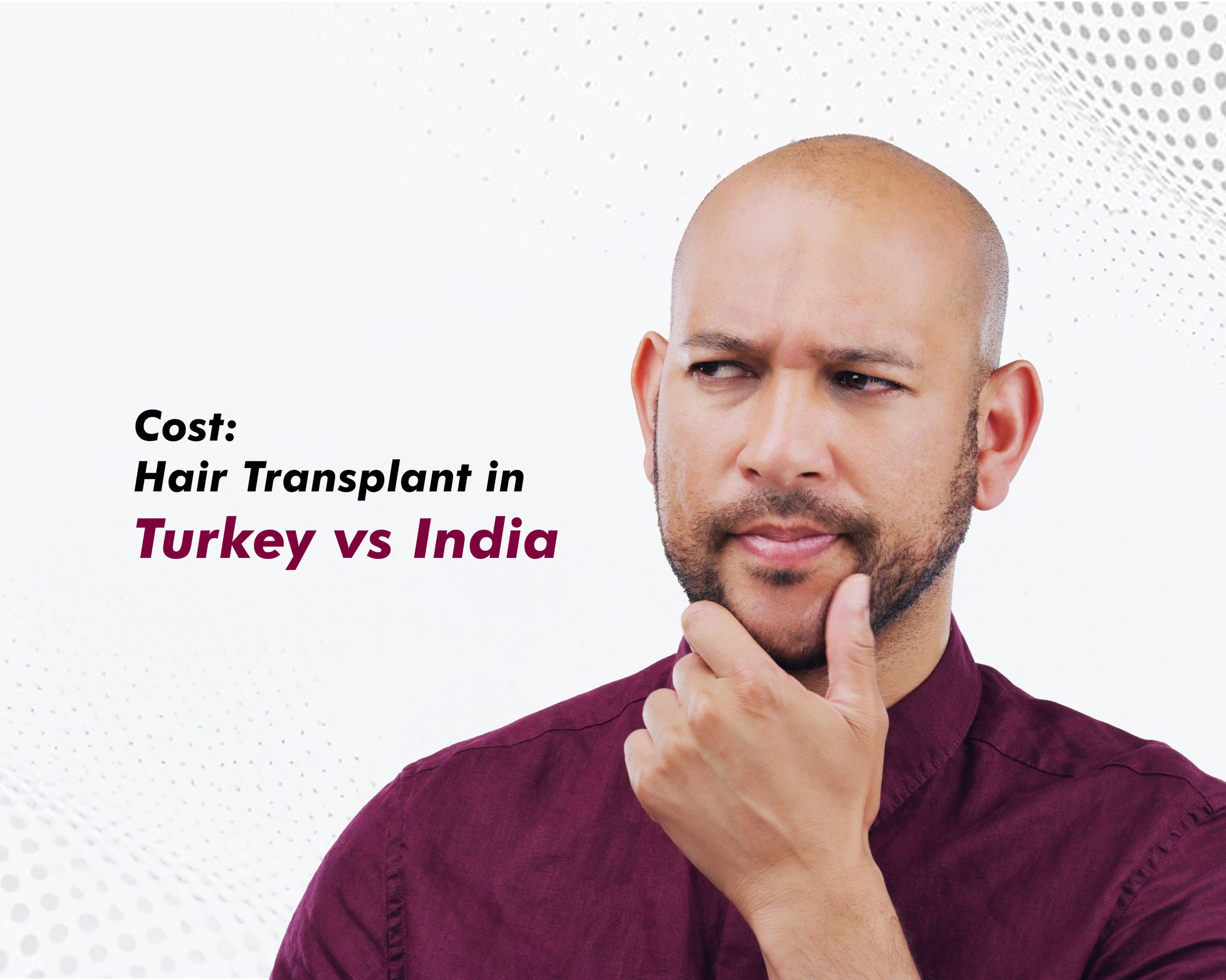 Hair-Transplant-Cost-in-Turkey-vs-India