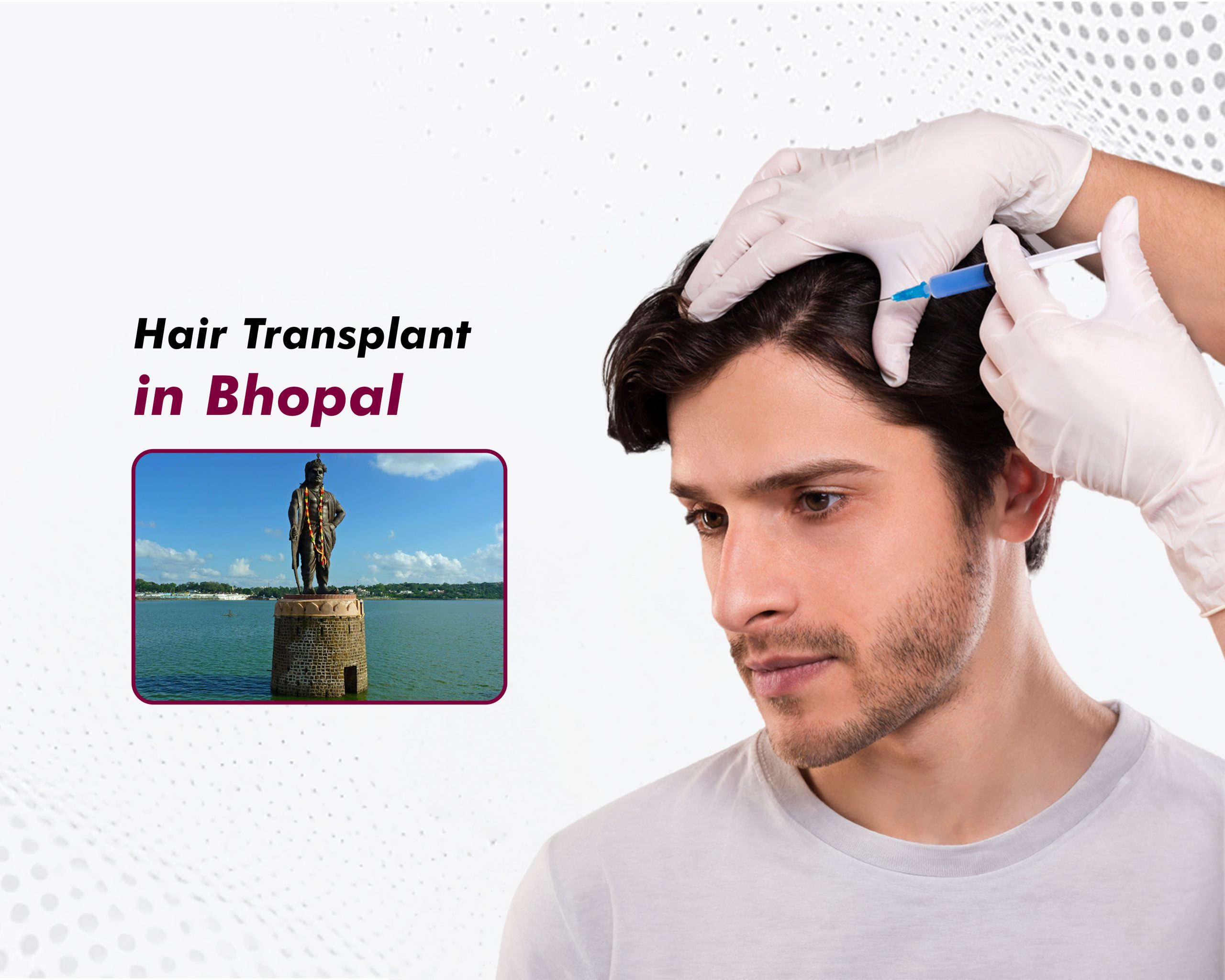 Hair Transplant in Bhopal