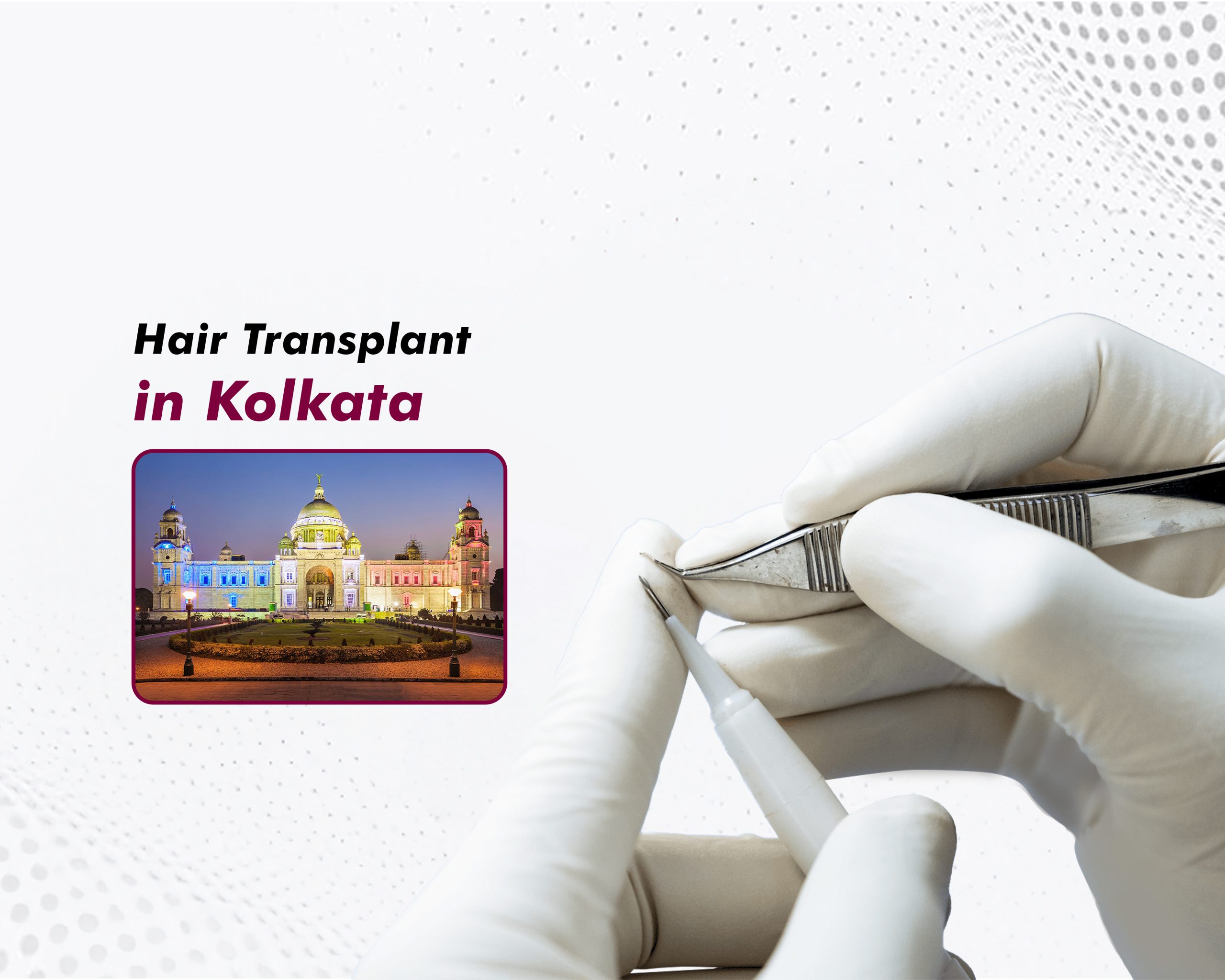 Hair Transplant in Kolkata