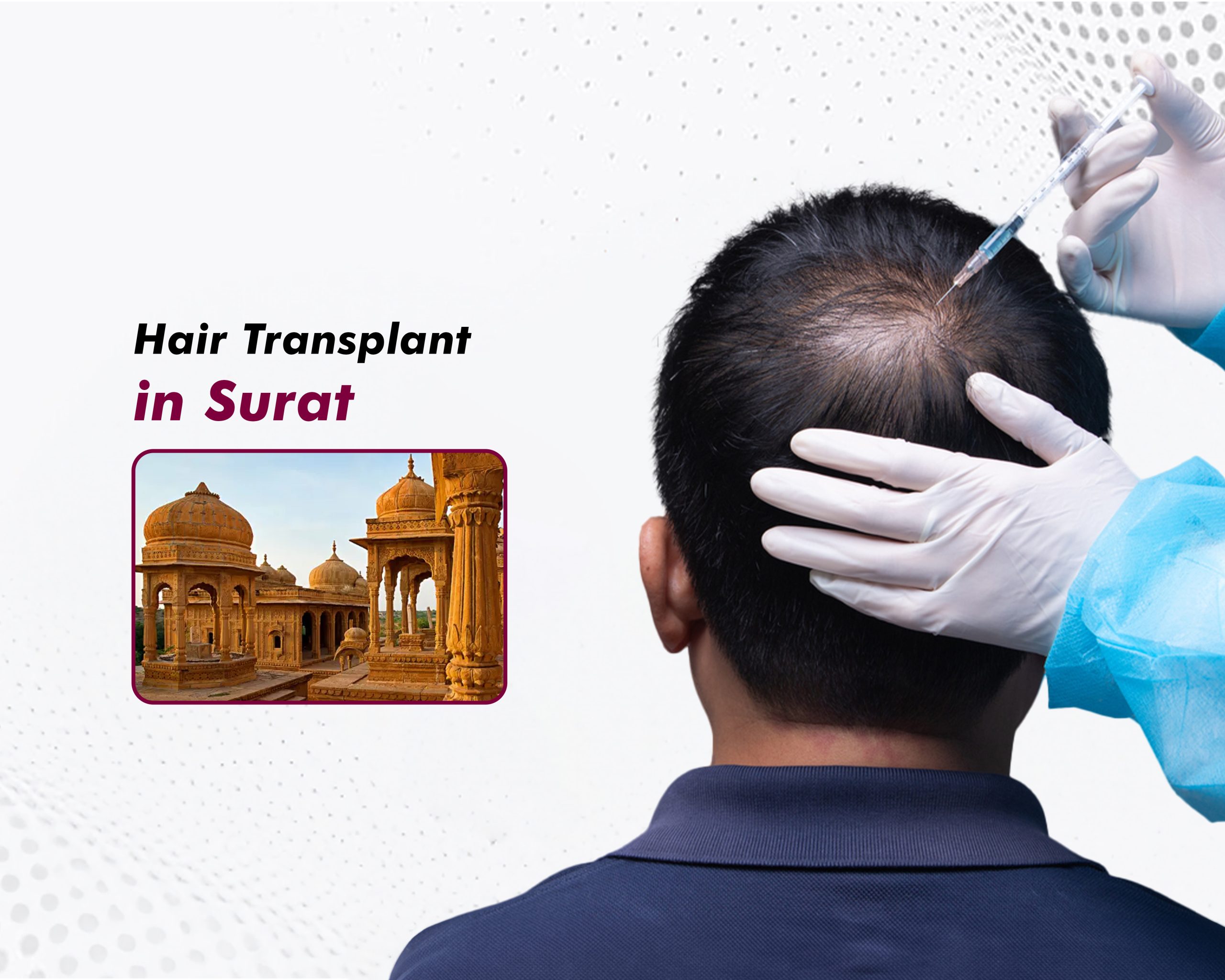 Hair Transplant in Surat