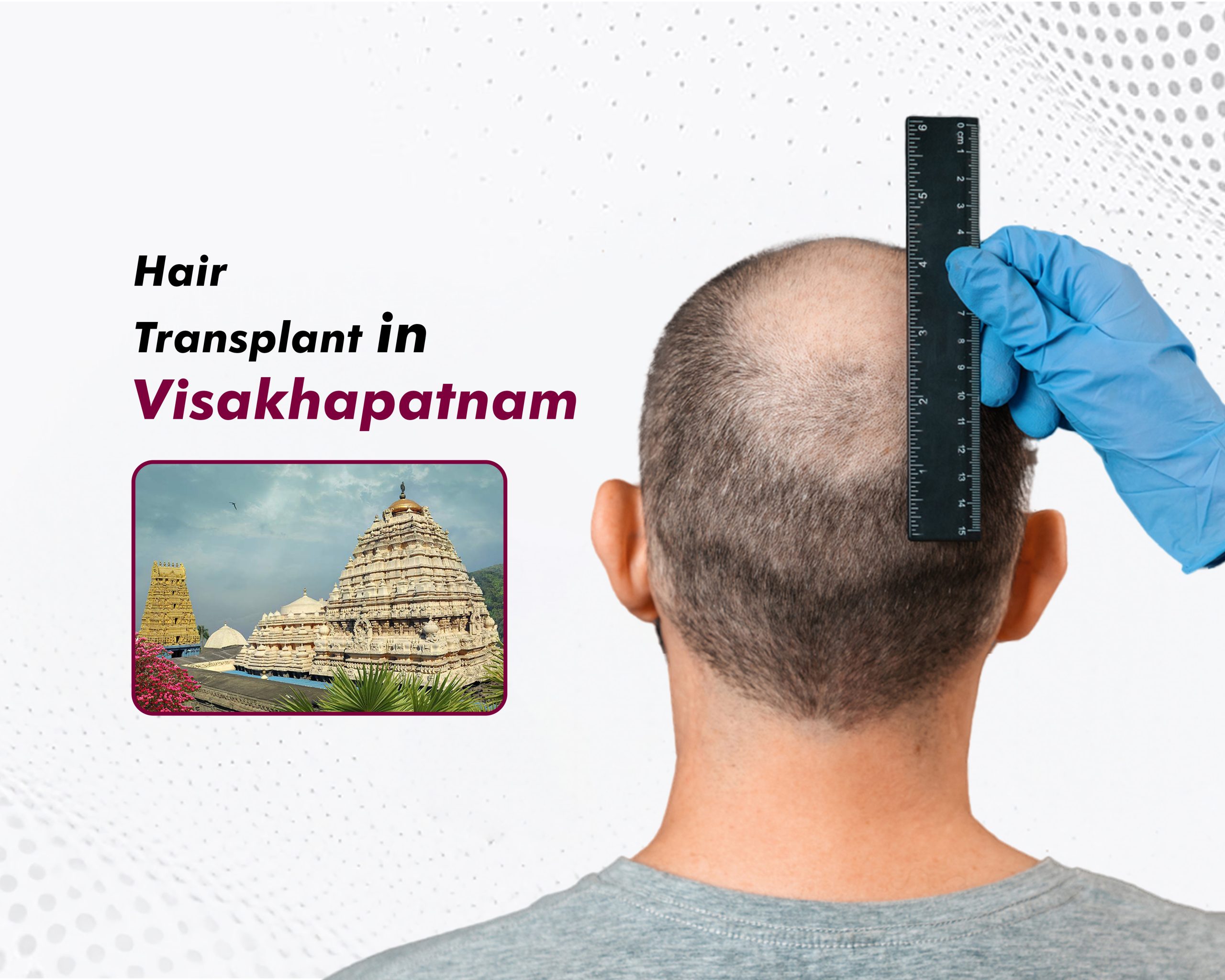 Hair Transplant in Visakhapatnam