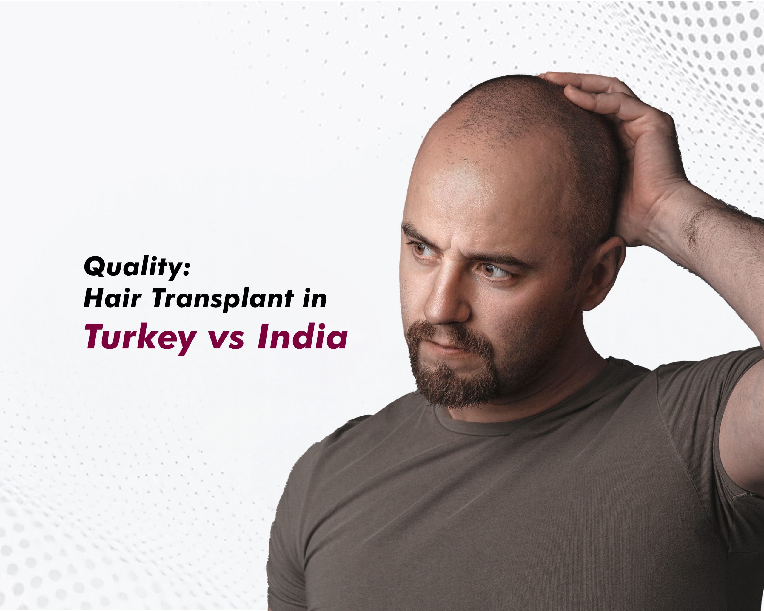 Quality-Hair-Transplant-in-Turkey-vs-India