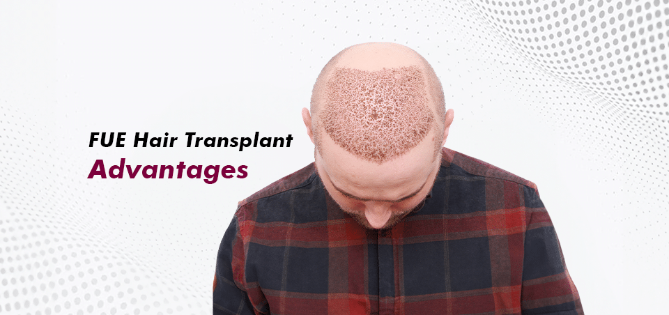 FUE Hair Transplant Advantages