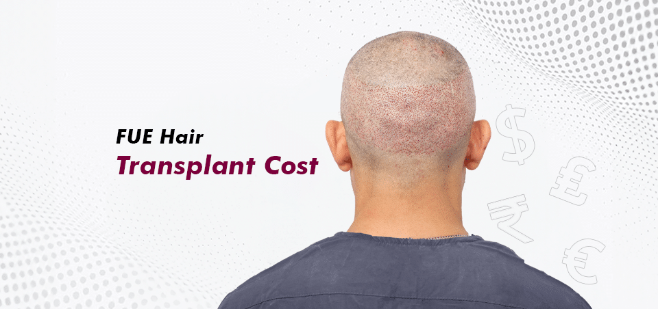 FUE Hair _Transplant Cost