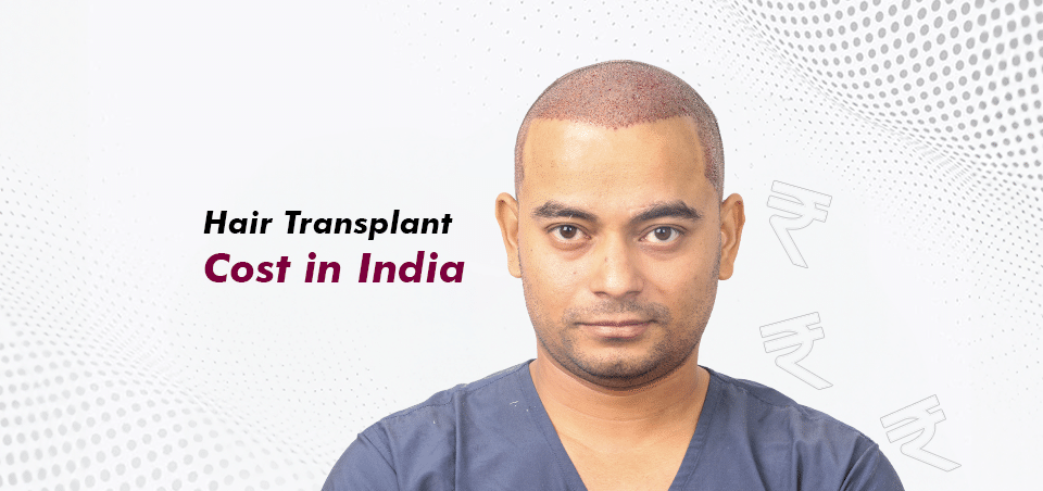 Hair Transplant Cost in India