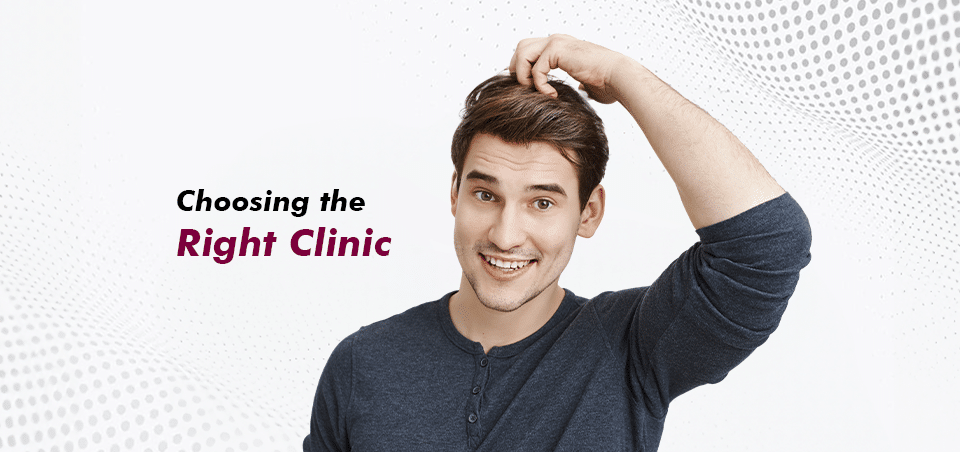 Hair Transplant Expert Advice - Choosing the Right Clinic