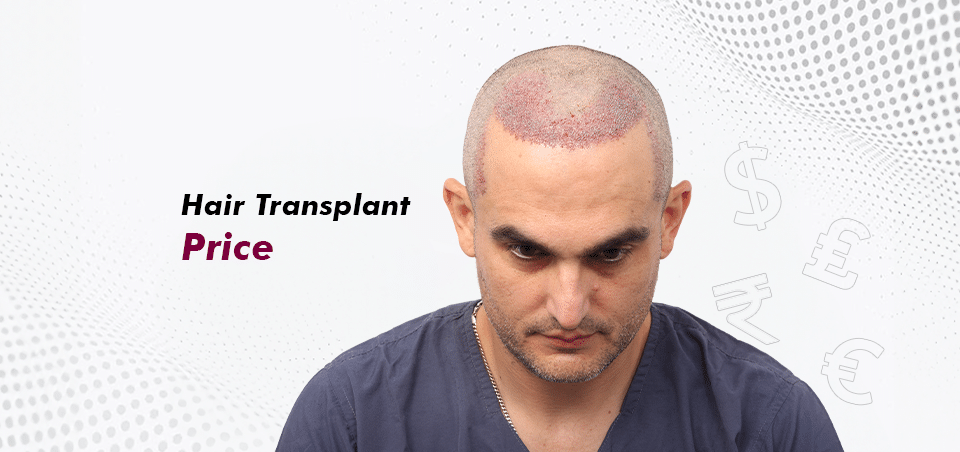 Hair Transplant Price